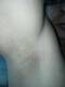 ascelle
