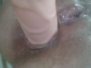 Anal Pt 1